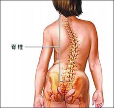 脊柱畸形要掌握正确的护理方式