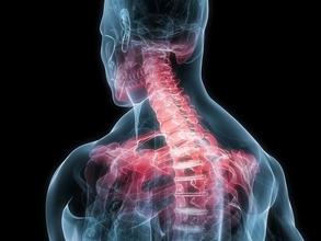 有什么方法可以预防脊柱畸形