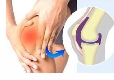 膝盖积水的治疗方法.jpg