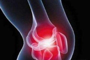 化脓性膝关节炎如何治疗.jpg