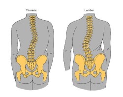 脊柱侧弯会出现哪些症状.jpg